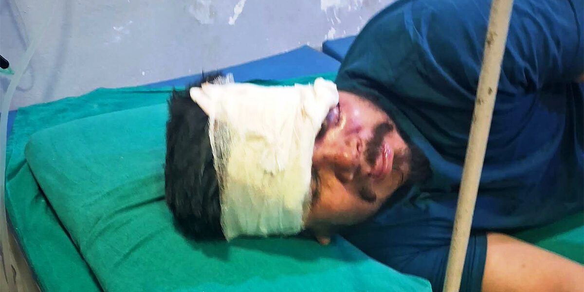 निर्माण व्यवसायी समाज घिमिरेमाथि खुकुरी प्रहार, उपचार जारी